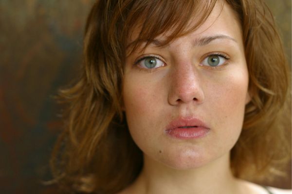 Benefits of Niacinamide Serum