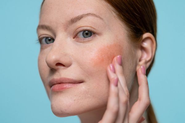 How to Repair Skin Barrier