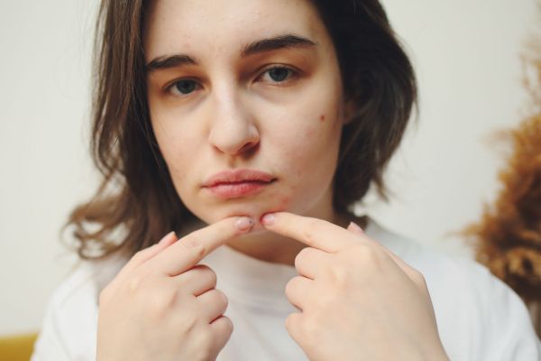 How to Repair Skin Barrier